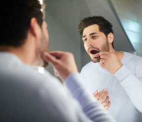 Man with lost filling looking at his tooth in the mirror