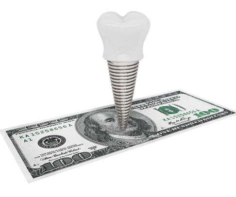 dental implant and money for cost of dental implants in Mankato 