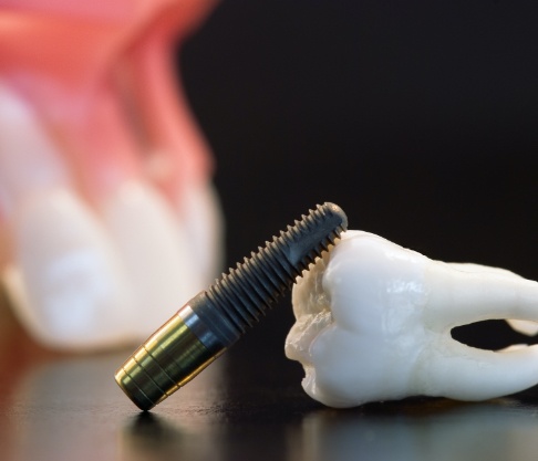 Model tooth and sample dental implant post