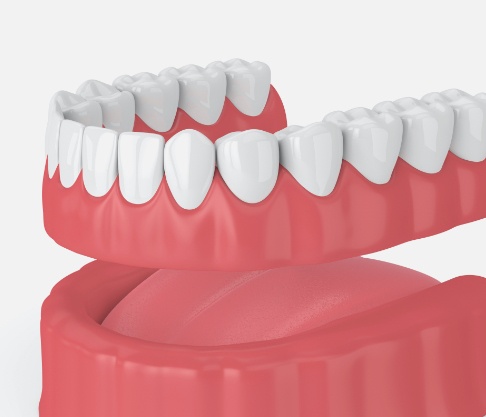Animated smile during denture placement