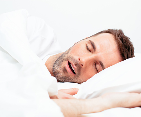 Man in white bed sheets, sleeping with mouth open