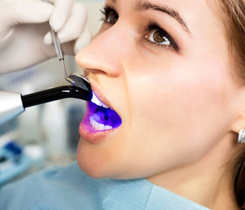 Teeth whitening treatment