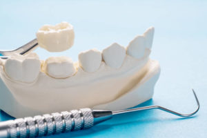 Model of a dental crown and probe